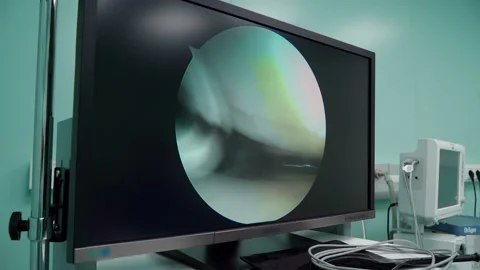 Monitor in the operating room 스톡 동영상 164313194