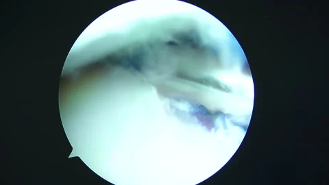 Monitor in the operating room Stock Footage 165002442