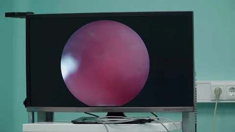 Monitor in the operating room 스톡 동영상 165335268