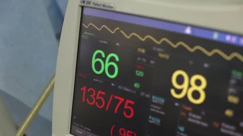 The monitor in the operating room shows the patient's pulse 库存影片 80967772