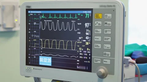 The monitor a patient in the operating room Stock Footage 52712486