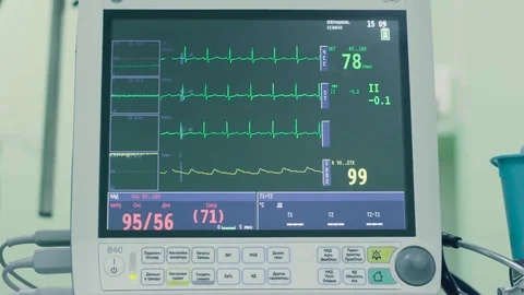 The monitor a patient in the operating room Video stock 75154795