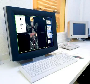 Monitor  pet/ic scan Stock Photos