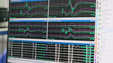 Monitor with running curved lines. Stock Footage 254759985