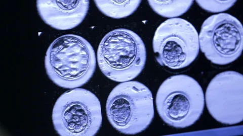 On monitor screen, photographs of stages of development of human embryo, eco Stock Footage 128644526