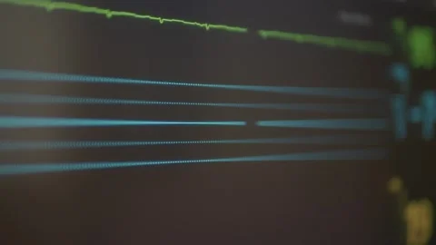 Monitor shows data and readings from medical equipment Stock Footage 325442019
