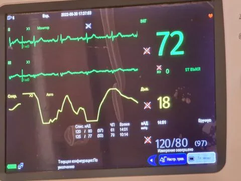 The monitor shows the work of the heart in intensive care Stock Photos
