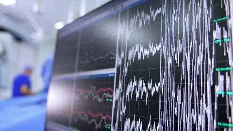 Monitor split into segments with brain waves changing shapes.  動画素材 281772748