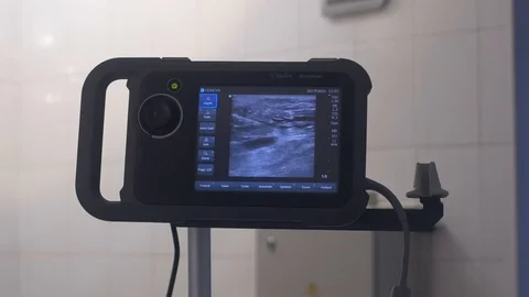 Monitor for tracking the operation of varicose veins Видео 73576689