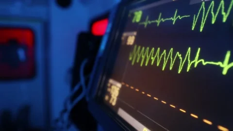 Monitor of vital signs inside of ambulance car of emergency medic 스톡 동영상 293207549