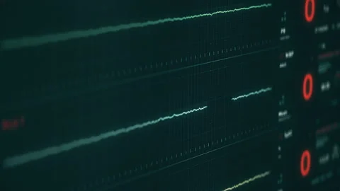 Monitoring equipment displaying the flat line graph of the vital health markers Stock Footage 211843094