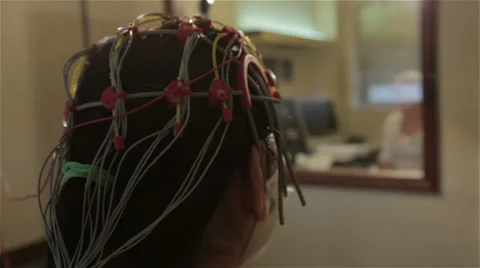 Monitoring functions of brain, head close up. Neurology, neurologist, patient. 動画素材 52675552