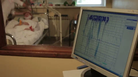 Monitoring functions of brain. Neurology. Eeg. Patient lying in hospital room. Video stock 52673377