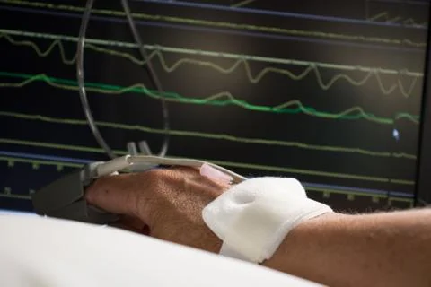 Monitoring of patient. Stock Photos