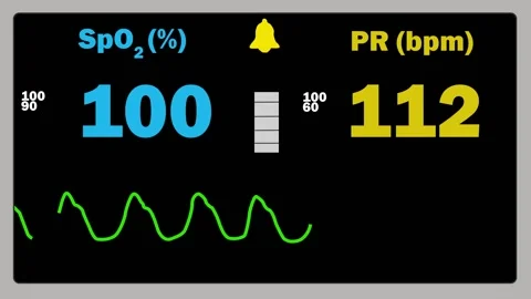 Monitoring Pulse Oximetry -SPO2 Stock Footage 148508501