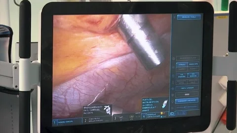 MONITORING A SURGICAL MACHINE OPERATING WITHIN THE HUMAN BODY Stock Footage 201741618
