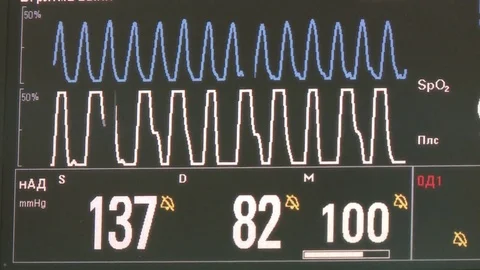 Monitoring of vital functions during surgery 動画素材 72898983