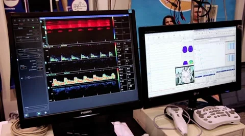 Monitors with diagrams Stock-Footage 8836115