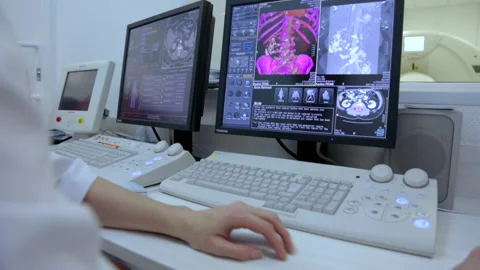 Monitors in Office Computer Tomography. Doctor. MRI Machine. Laboratory Research Stock Footage 164634407