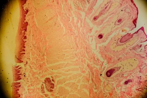 Monkey lip section showing stratified epithelium and gland 스톡 사진