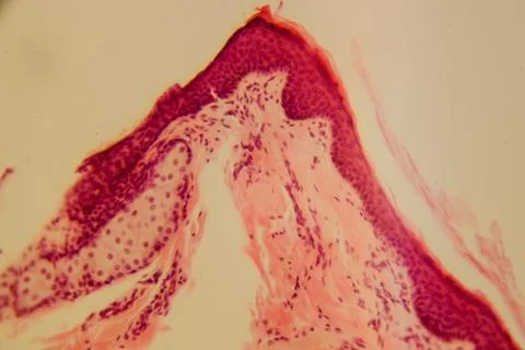 Monkey lip section showing stratified epithelium and gland 스톡 사진