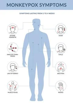 Monkey pox symptoms infographic. It cause skin infections. Flat line vector i Illustrazione stock