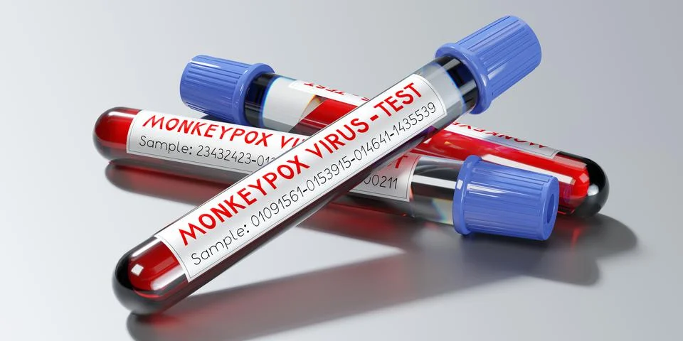 Monkey pox virus blood test vials - 3D illustration Illustrazione stock