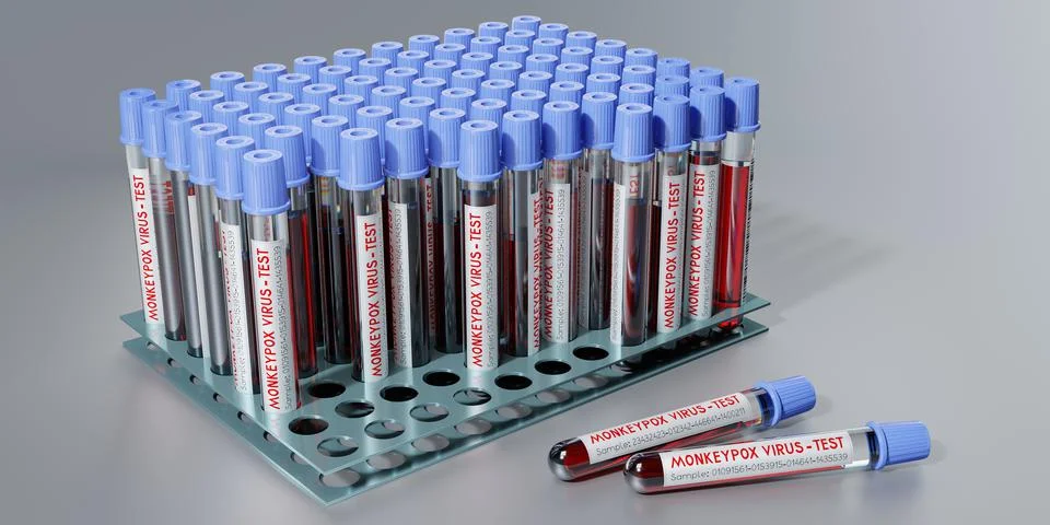 Monkey pox virus blood test vials - 3D illustration Illustrazione stock