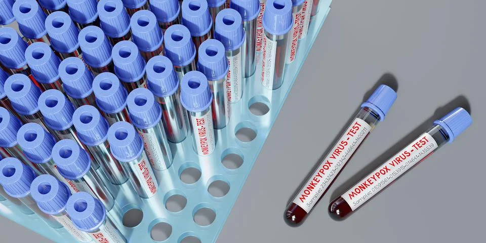 Monkey pox virus blood test vials - 3D illustration Illustrazione stock