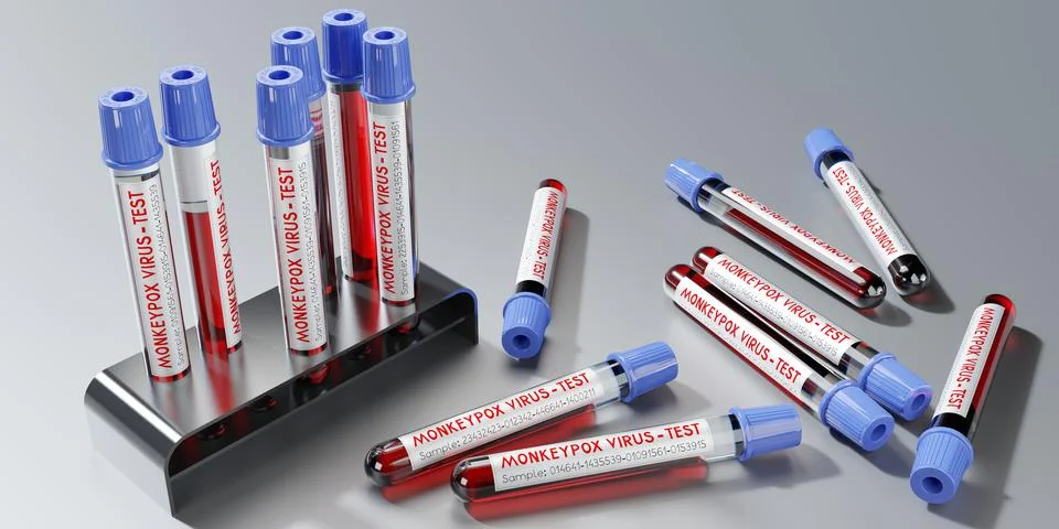 Monkey pox virus blood test vials - 3D illustration Stock Illustration