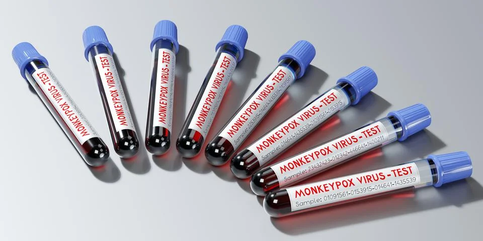 Monkey pox virus blood test vials - 3D illustration Stock Illustration