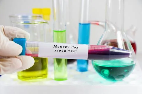 Monkey Pox virus Stock Photos