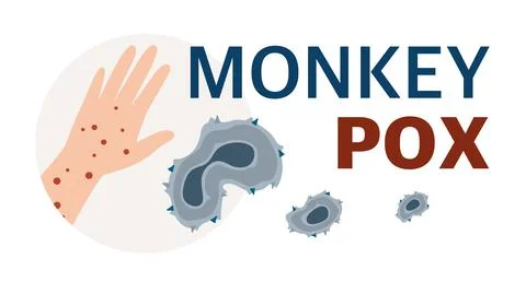 Monkey Pox virus Poster to inform about the pandemic and spread of the diseas Stock Illustration