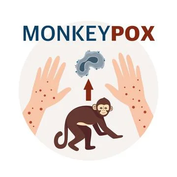 Monkey Pox virus Poster to inform about the pandemic and spread of the diseas Stock Illustration