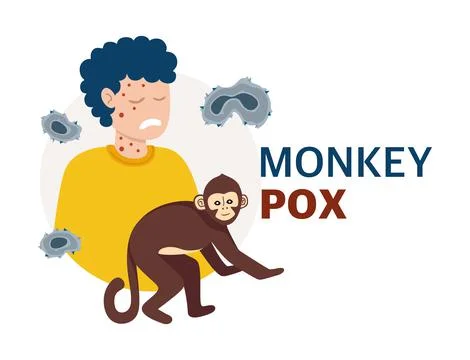 Monkey Pox virus Poster to inform about the pandemic and spread of the diseas Stock Illustration