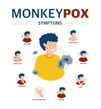 Monkey pox virus Poster to inform about the pandemic and the spread of the di Stock Illustration