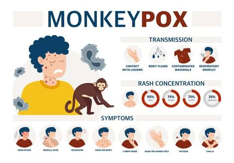 Monkey pox virus Poster to inform about the pandemic and the spread of the di Stock Illustration