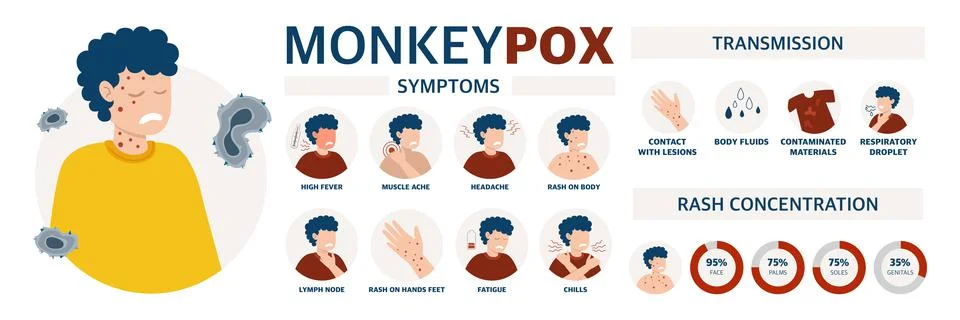 Monkey pox virus Poster to inform about the pandemic and the spread of the di Stock Illustration