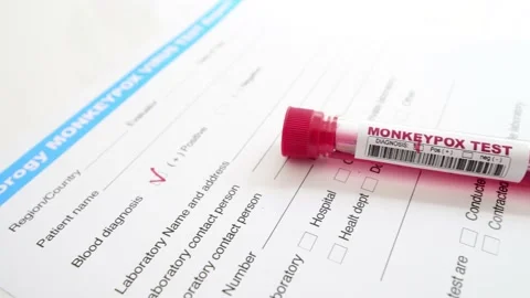 Monkeypox blood test Stock Footage 202593037