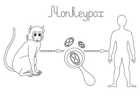 Monkeypox. Diagram of human infection with the smallpox virus. Sketch. Illustrazione stock