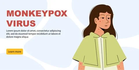 Monkeypox outbreak concept banner. Infected girl from monkey flat illustrat.. Stock Illustration