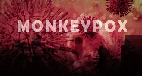 Monkeypox outbreak concept. Monkeypox is caused by monkeypox virus. Monkeypox 库存照片