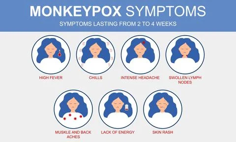 Monkeypox outbreak. Monkeypox virus symptoms infographic. Stock Illustration