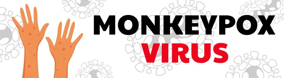 Monkeypox virus poster. Web banner of monkey pox skin infection of person. Stock Illustration