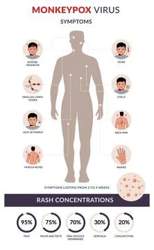 Monkeypox virus symptoms flat vector infographic. Rash concentration. Outbrea 库存插图