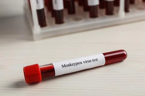 Monkeypox virus test. Sample tube with blood on wooden table Stock Photos