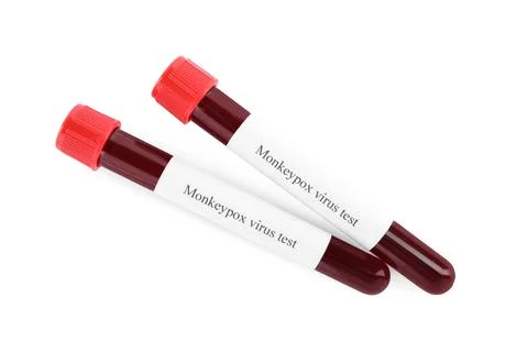 Monkeypox virus test. Sample tubes with blood on white background Stock Photos