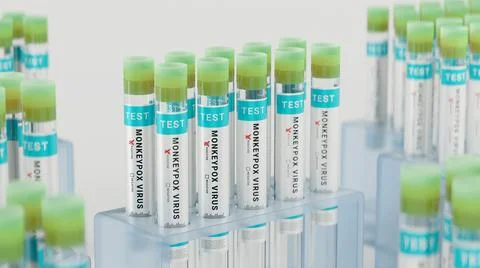 Monkeypox virus test tubes in a vial rack in a healthcare laboratory Stock Illustration