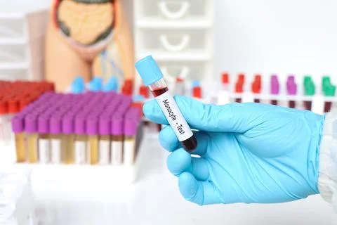 Monocyte test, blood sample to analyze in the laboratory Stock Photos
