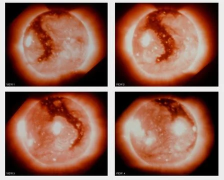 This montage is a sequence of soft x-ray photographs of the boot-shaped cor.. Stock Photos